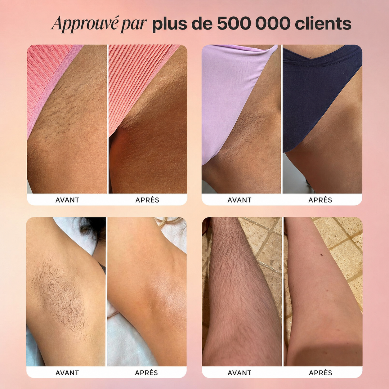 dermwave