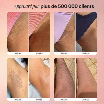 dermwave