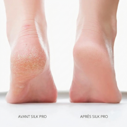 Bliss Silk Pro 2 – Des pieds doux sans visites coûteuses en salon